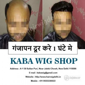 Hair Wig in Delhi
