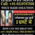 Hair Wig Shop in Delhi, Hair Patch